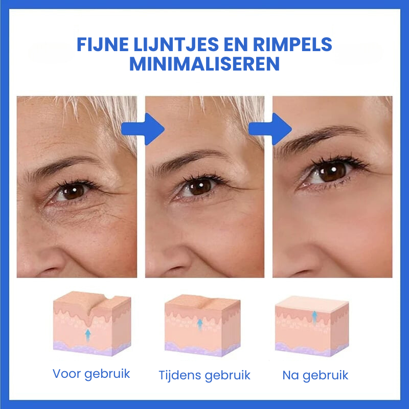 SkinLift™ | Botox Gezicht Serum