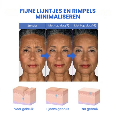 SkinLift™ | Botox Gezicht Serum