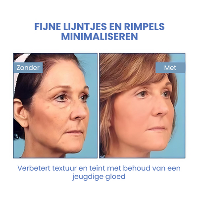 SkinLift™ | Botox Gezicht Serum