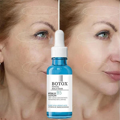 SkinLift™ | Botox Gezicht Serum